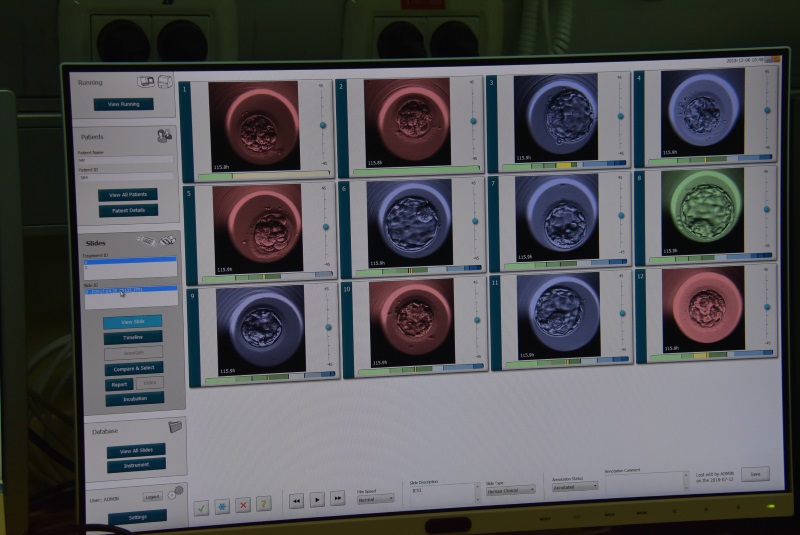 האמבריוסקופ