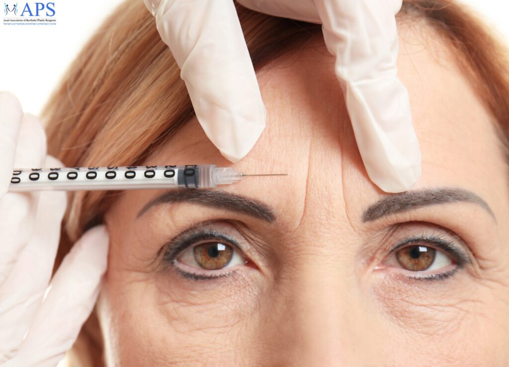 בתמונה אישה שמזריקים לה בוטוקס למצח