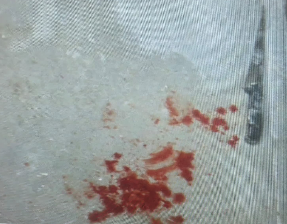 תיעוד הסכין והזירה – קרדיט: דוברות המשטרה